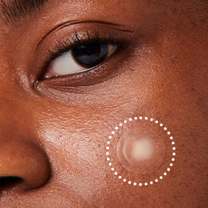 TimeoutBlemishPatch_DarkSpot_A_Contents300_07.jpg