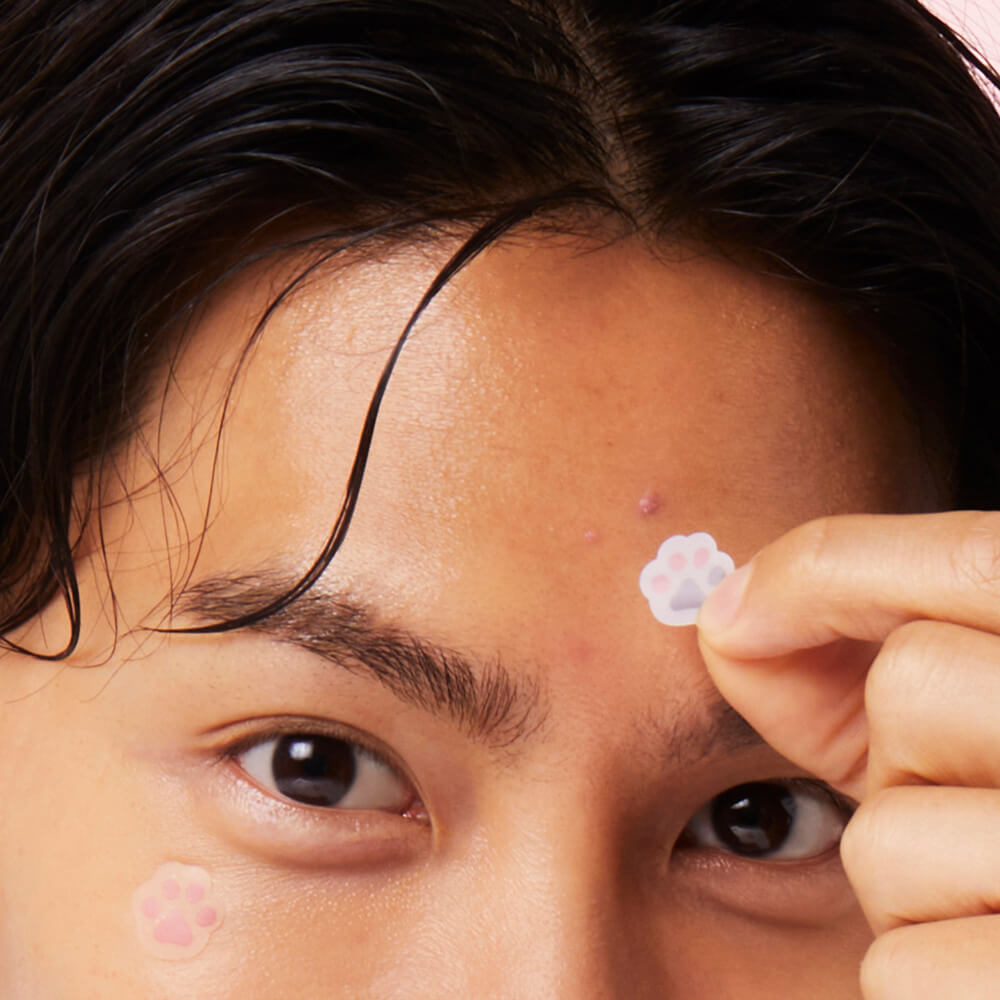best acne patch - facial blemish stickers