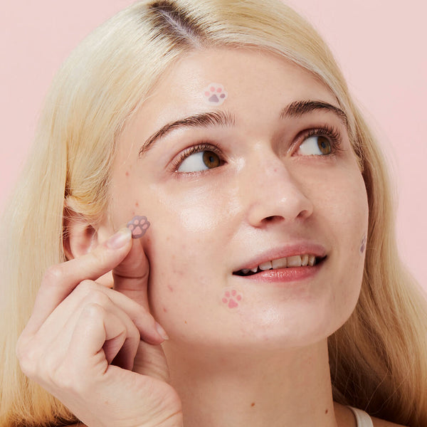 best acne patch - facial stickers