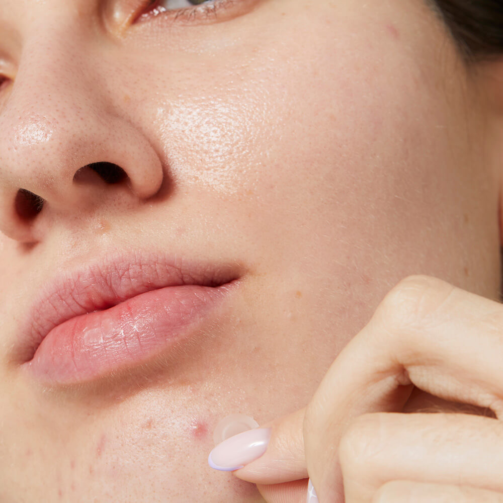 I DEW CARE Timeout Blemish Patch Original Hydrocolloid Spot Treatment